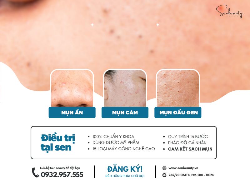 Trị các loại mụn nhọt trứng cá có cam kết